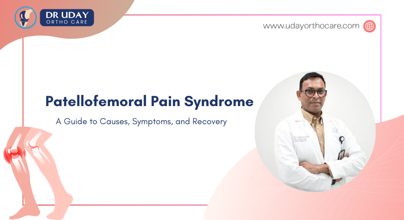 Patellofemoral Pain Syndrome: Understanding and Managing Runner’s Knee